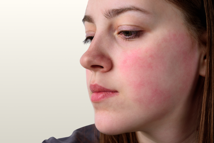 5 steps to create resilient skin