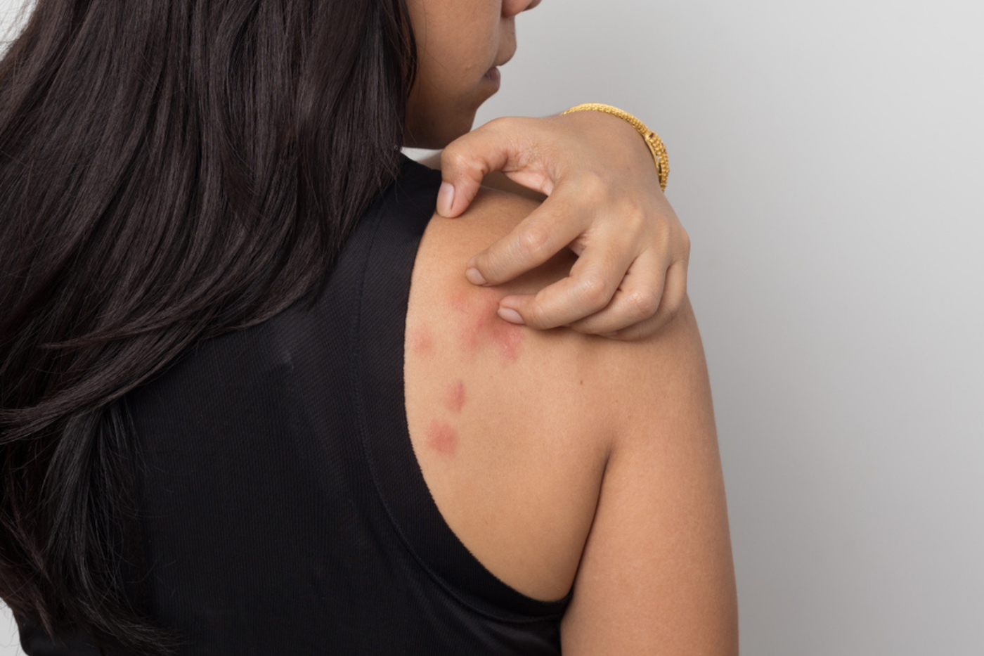Is the weather making your skin condition worse?