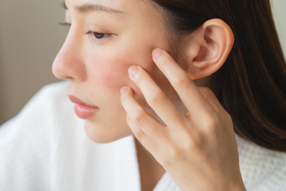 The Layered guide to eczema
