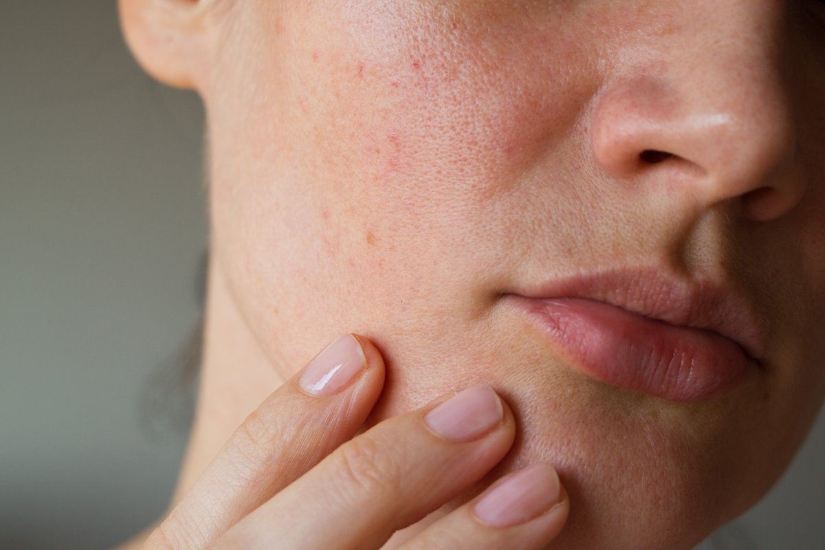 Is it possible to override your skincare genetics?