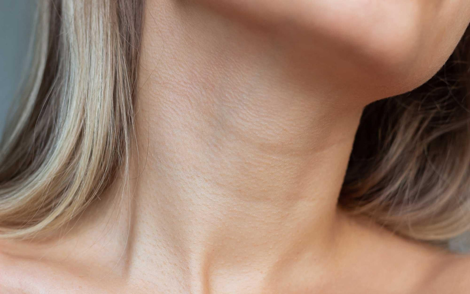 This Combination of Aesthetic Treatments Is The Way To Go for Necklace Lines