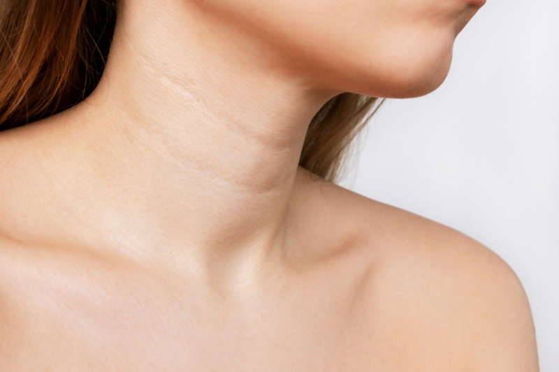 Botulinum toxin and the neck — a perfect match?