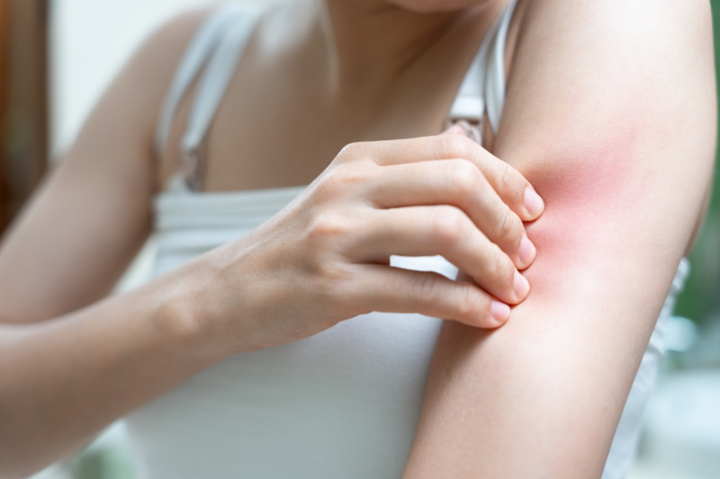 The Layered guide to psoriasis