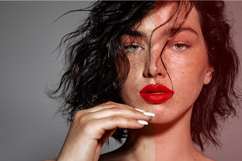 Cysteamine – is this the wonder ingredient for pigmentation?