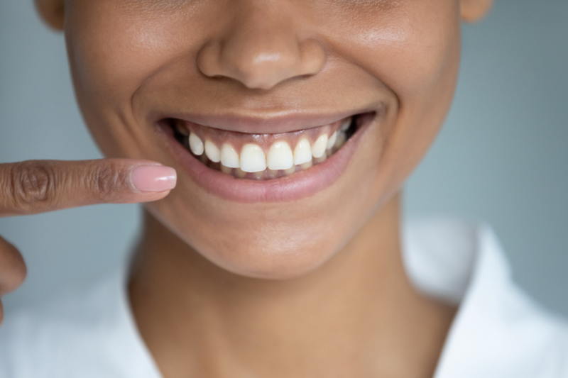 The smile lift and other dentistry trends to watch
