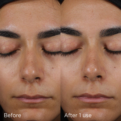 Before and after of a woman’s face showing the effects of using IMAGE Skincare Daily Prevention Sheer Matte Moisturiser SPF 30.