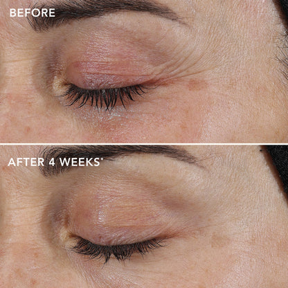 AGELESS+ retinol repair crème 0.3% retinol complex